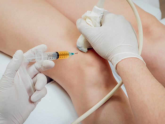 Corticosteroid Injections