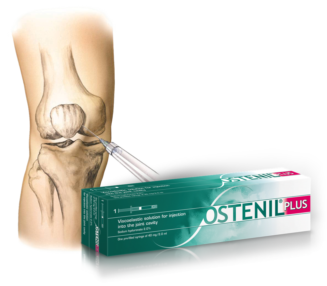 Ostenil Injections